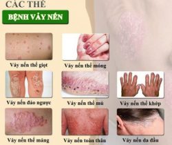 vay-nen-chua-duoc-khong